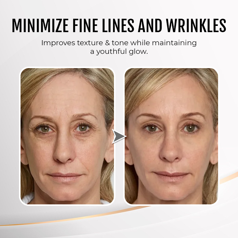 LIMETOW® Instant Eye Cream Tightener✨