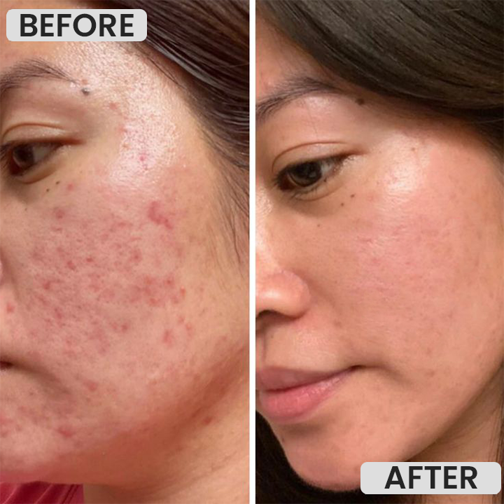 LIMETOW™ Magnetic Mask Mud