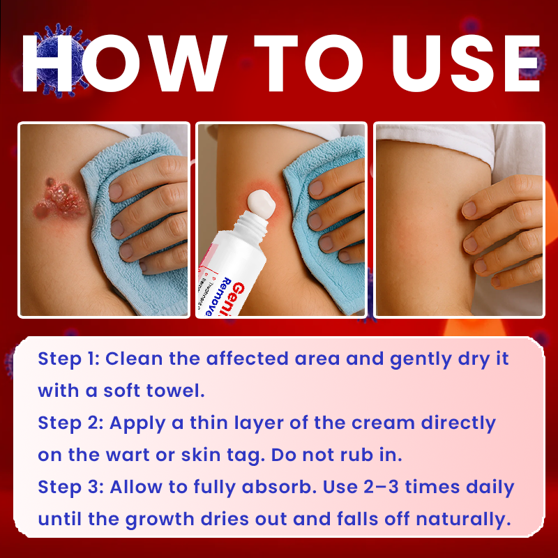 Official Store: LIMETOW® Genital Warts Remover Cream