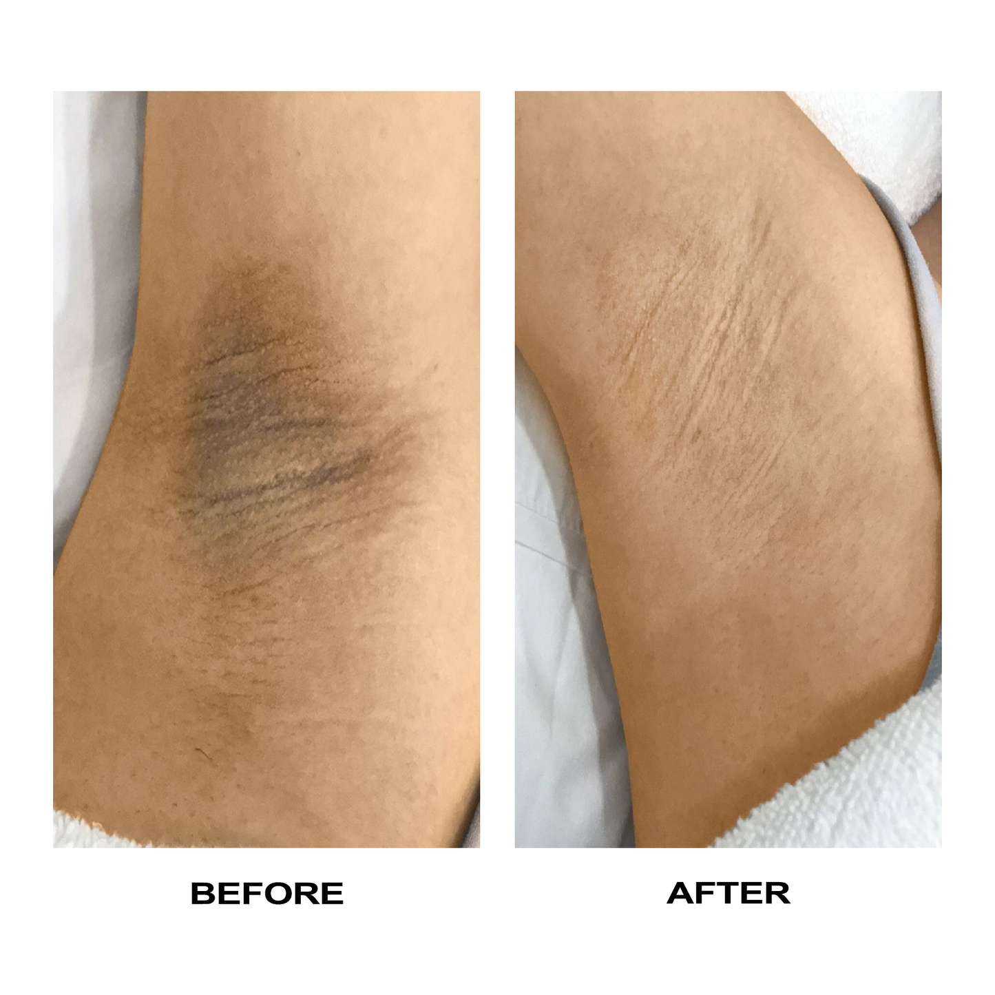 LIMETOW™ Vitamin C Whitening Cream