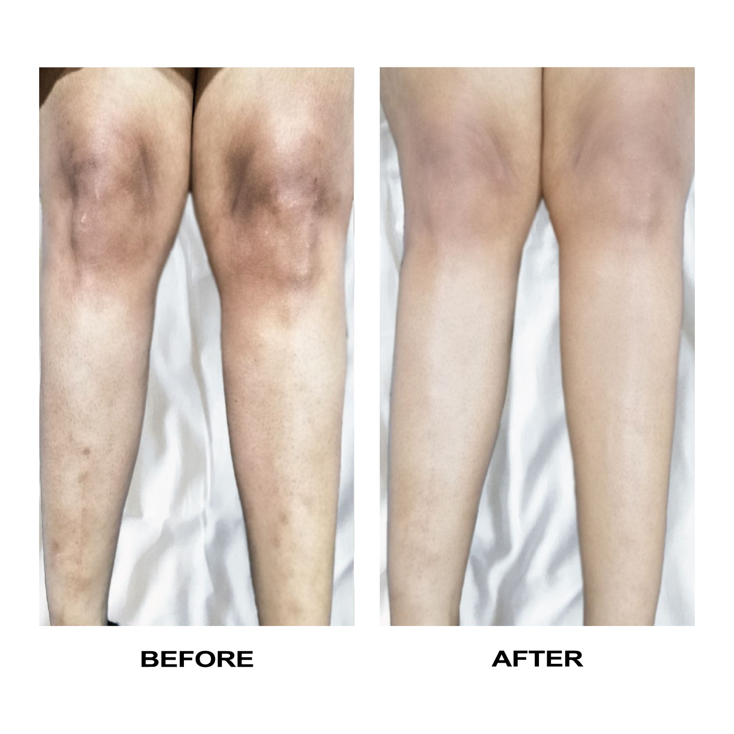 LIMETOW™ Vitamin C Whitening Cream