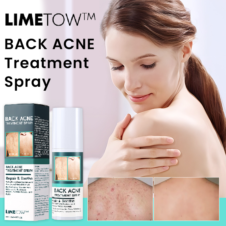 LIMETOW™ Back Acne Treatment Spray