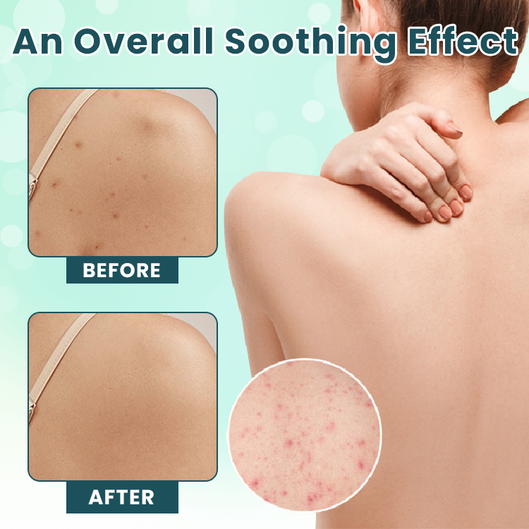 LIMETOW™ Back Acne Treatment Spray