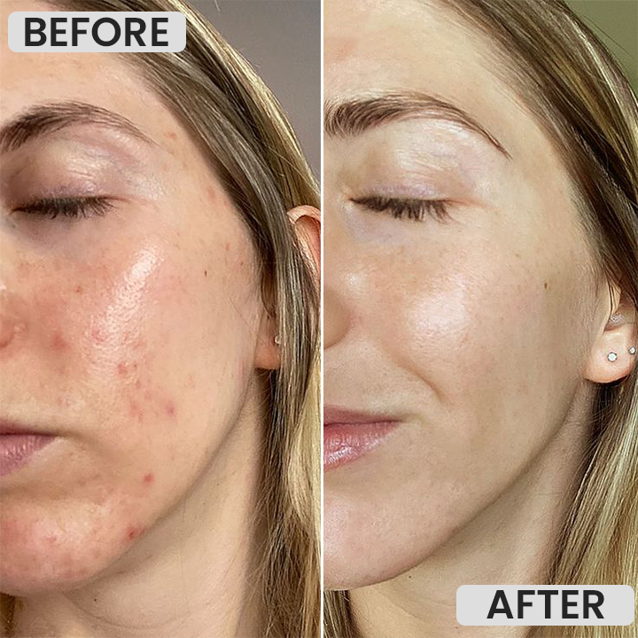 LIMETOW™ Magnetic Mask Mud