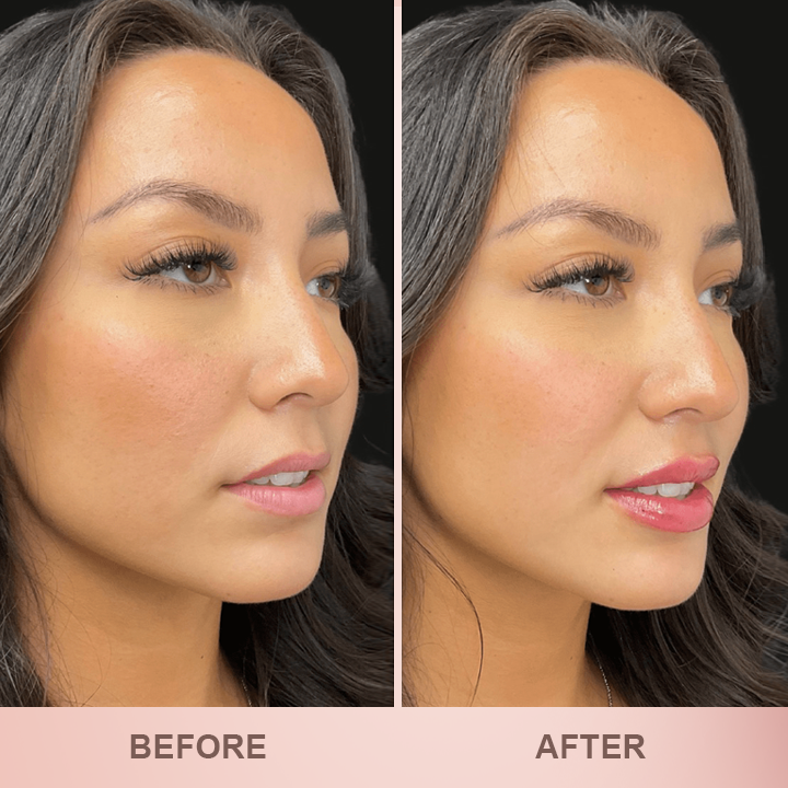More Value,Same Price✨LIMETOW® Lip Plumper Kit