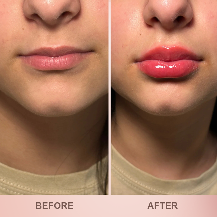 More Value,Same Price✨LIMETOW® Lip Plumper Kit