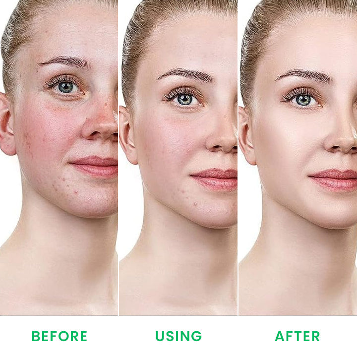 ⏰Last Day Discount⏰LIMETOW™ Tiger Grass Color Correcting Treatment