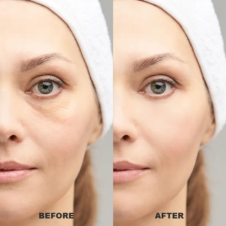👨⚕️💐Made and Shipped from USA✨LIMETOW™ Under Eye Puffiness Remover💝LAST DAY 50%OFF