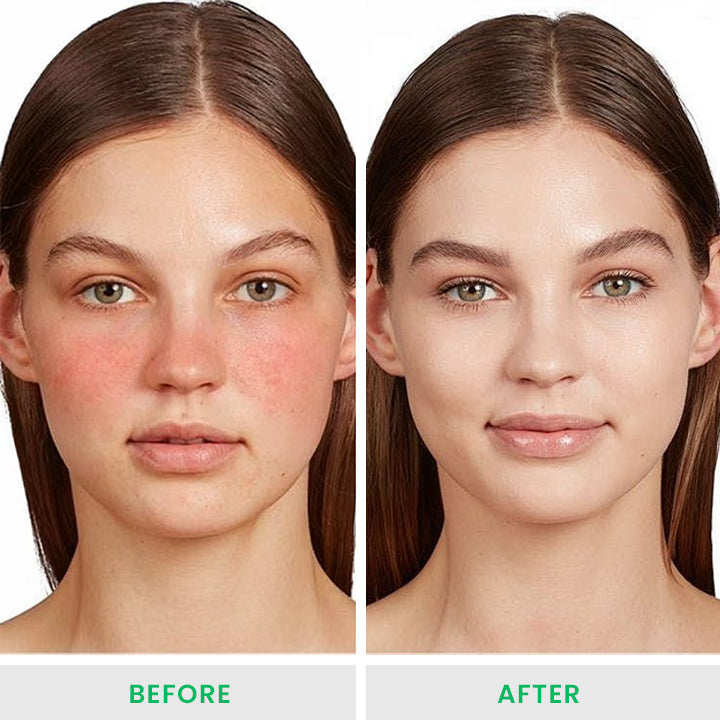 ⏰Last Day Discount⏰LIMETOW™ Tiger Grass Color Correcting Treatment