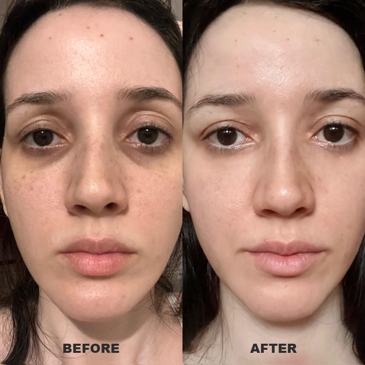 👨⚕️💐Made and Shipped from USA✨LIMETOW™ Under Eye Puffiness Remover💝LAST DAY 50%OFF