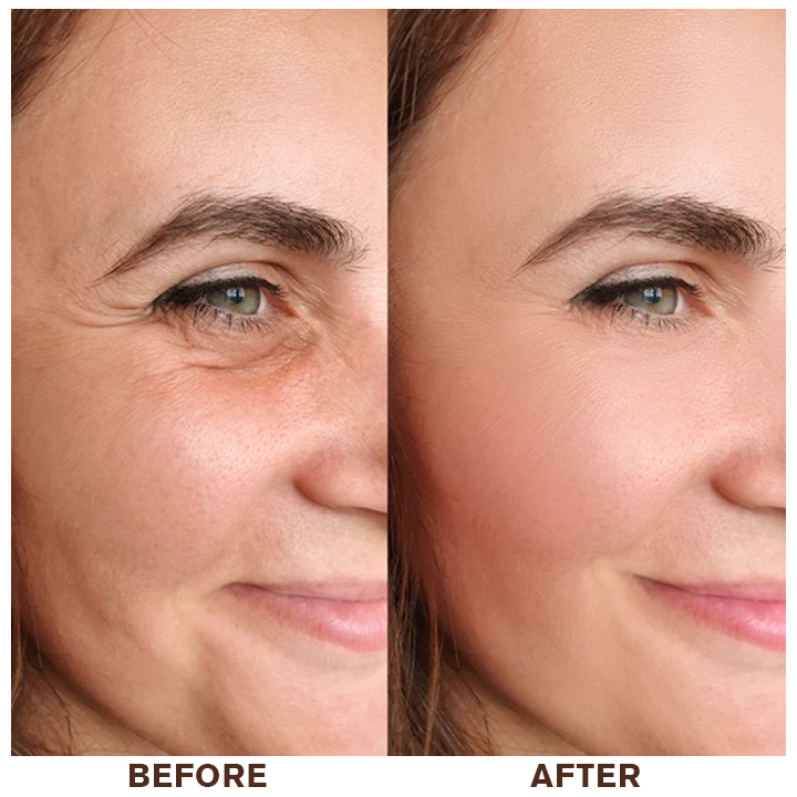 LIMETOW® Instant Eye Cream Tightener✨