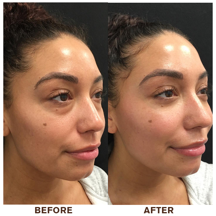 LIMETOW® Instant Eye Cream Tightener✨