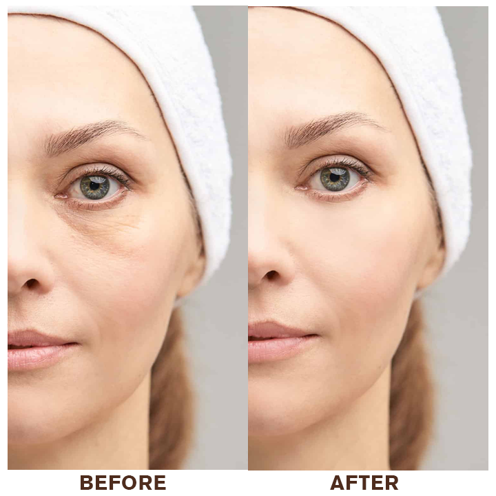 LIMETOW® Instant Eye Cream Tightener✨