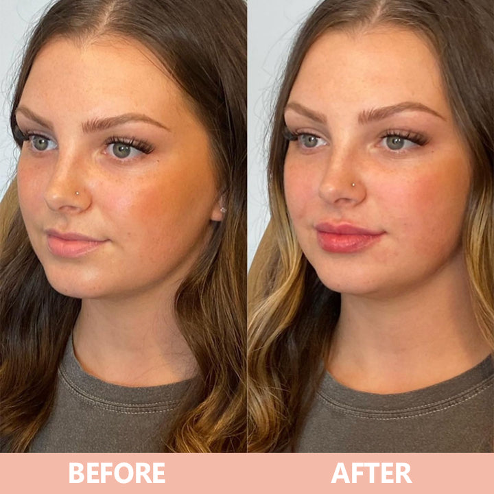 More Value,Same Price✨LIMETOW® Lip Plumper Kit