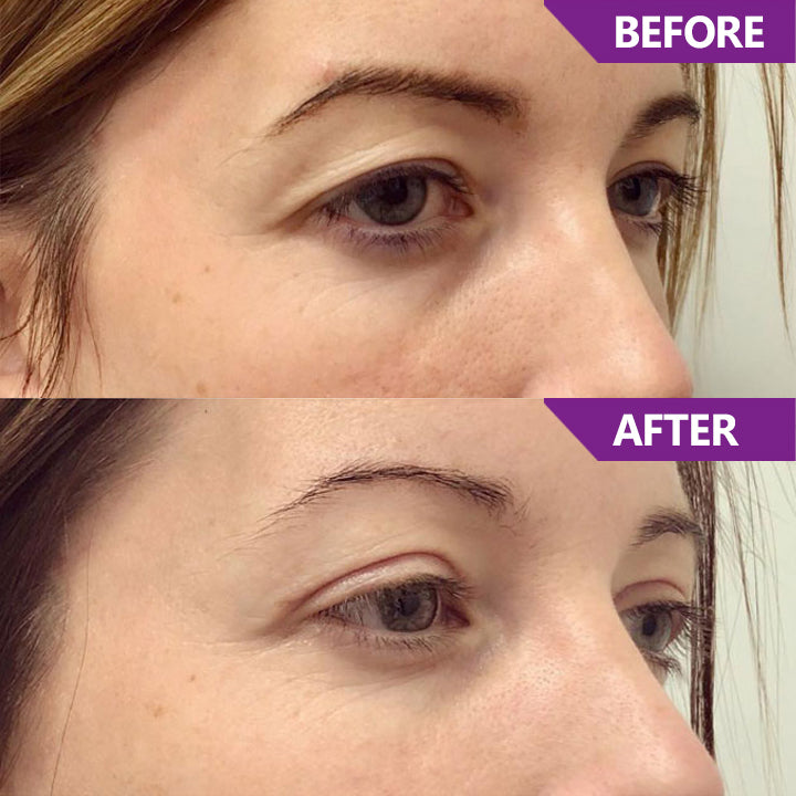 LIMETOW™ Magic Nighttime Double Eyelid Cream