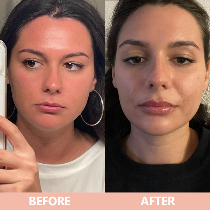More Value,Same Price✨LIMETOW® Lip Plumper Kit
