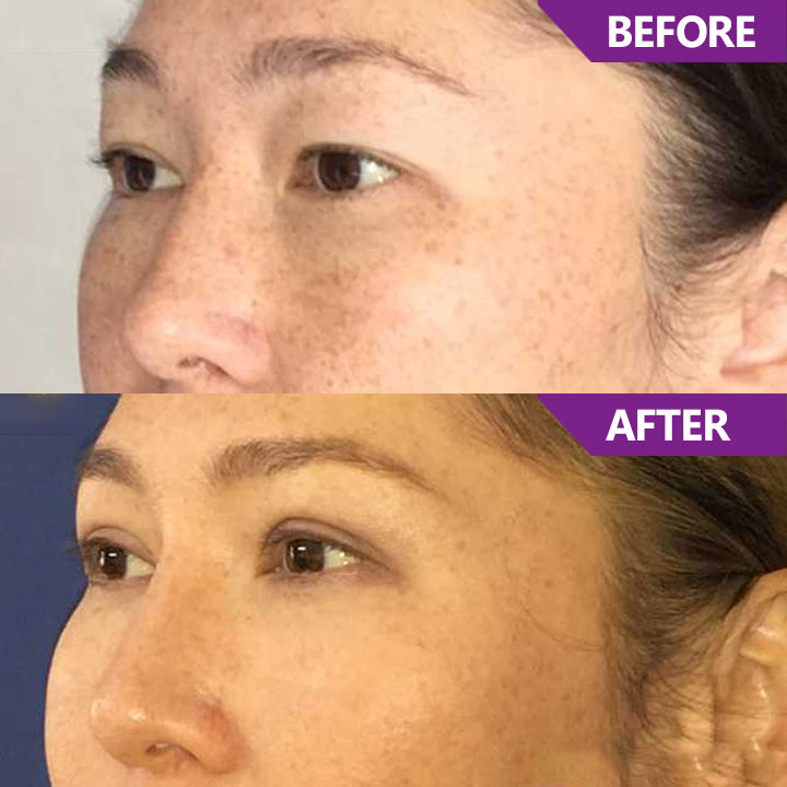 LIMETOW™ Magic Nighttime Double Eyelid Cream