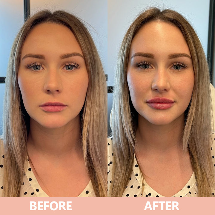 More Value,Same Price✨LIMETOW® Lip Plumper Kit