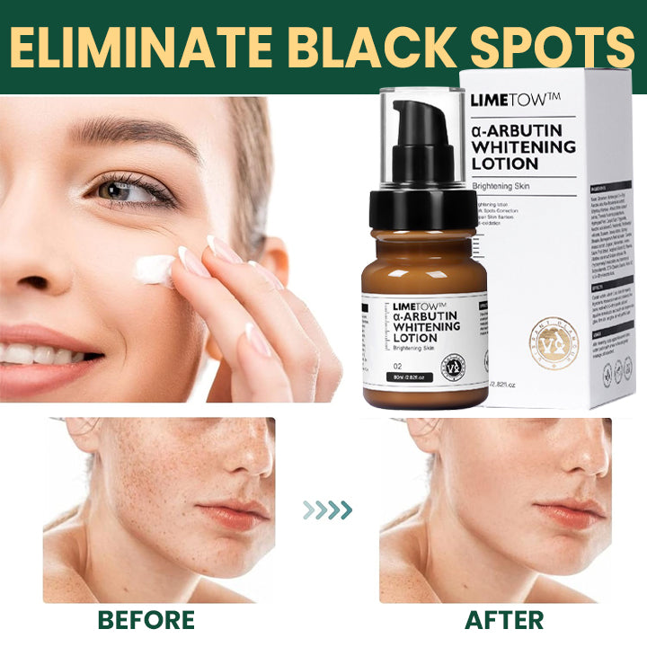 LIMETOW™ Alpha Arbutin Brightening Lotion