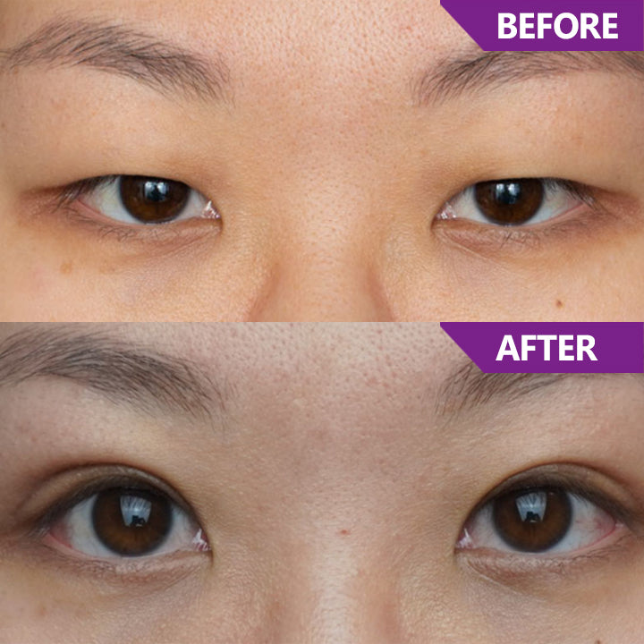LIMETOW™ Magic Nighttime Double Eyelid Cream