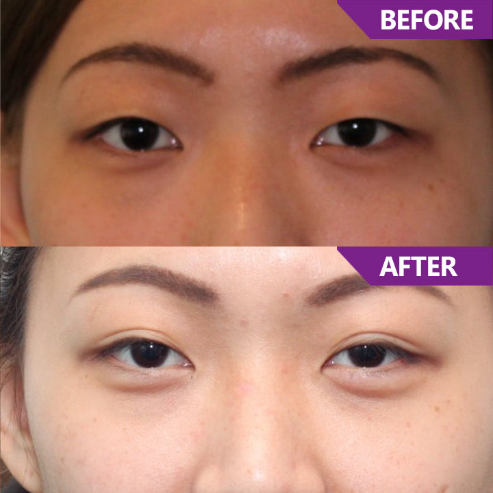 LIMETOW™ Magic Nighttime Double Eyelid Cream