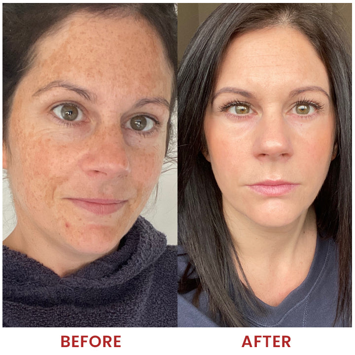 LIMETOW® Dark Spots Essence