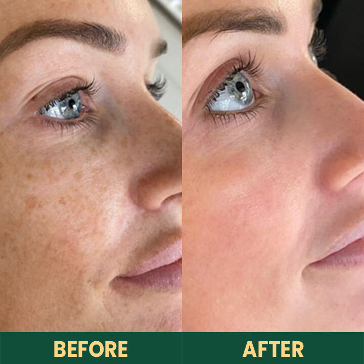 LIMETOW™ Alpha Arbutin Brightening Lotion