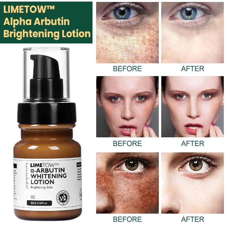LIMETOW™ Alpha Arbutin Brightening Lotion