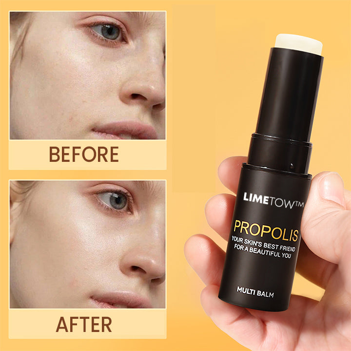 LIMETOW™ Propolis Essence Anti-Wrinkle Moisturizing Stick