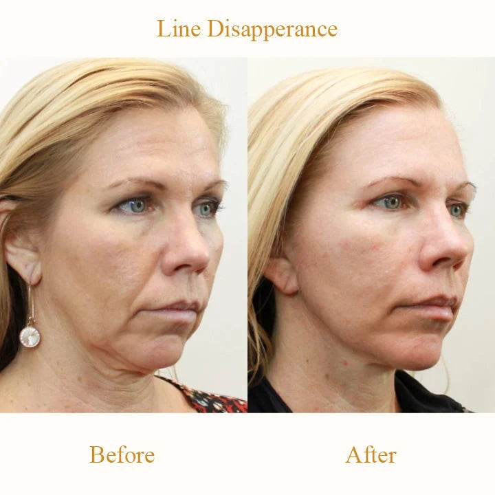 LIMETOW™ Plumping Anti-Wrinkle Silicon Patches
