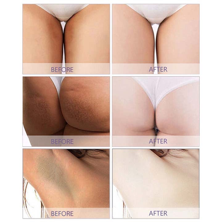 LIMETOW™ Dark Spot Correcting Cream