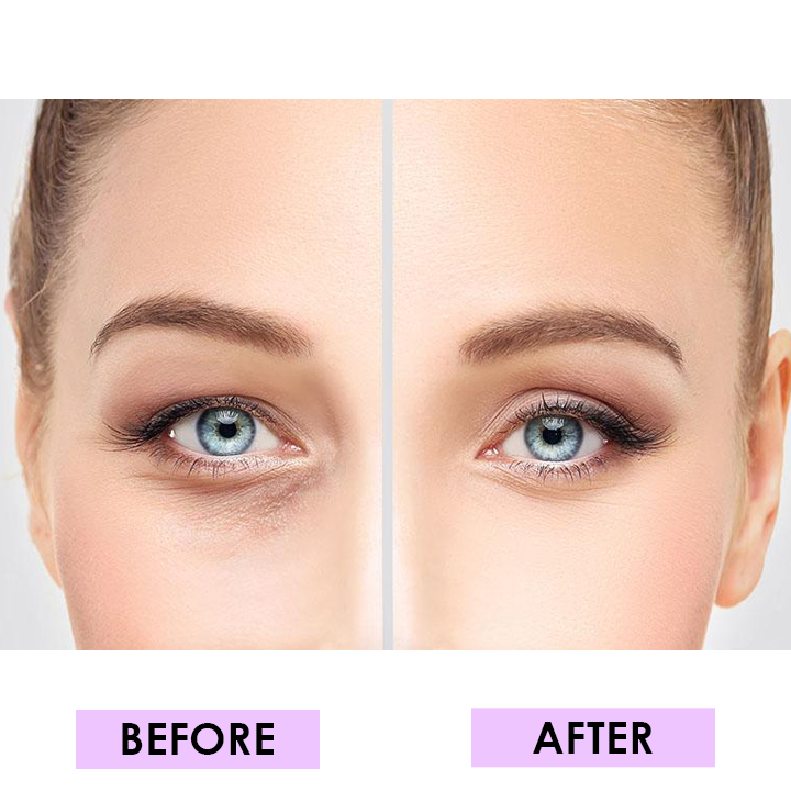 LIMETOW™ Anti-Wrinkle Magic Strips