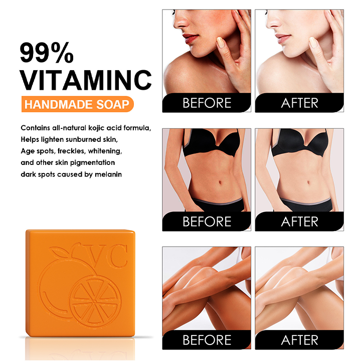 LIMETOW™ Vitamin C Whitening Soap