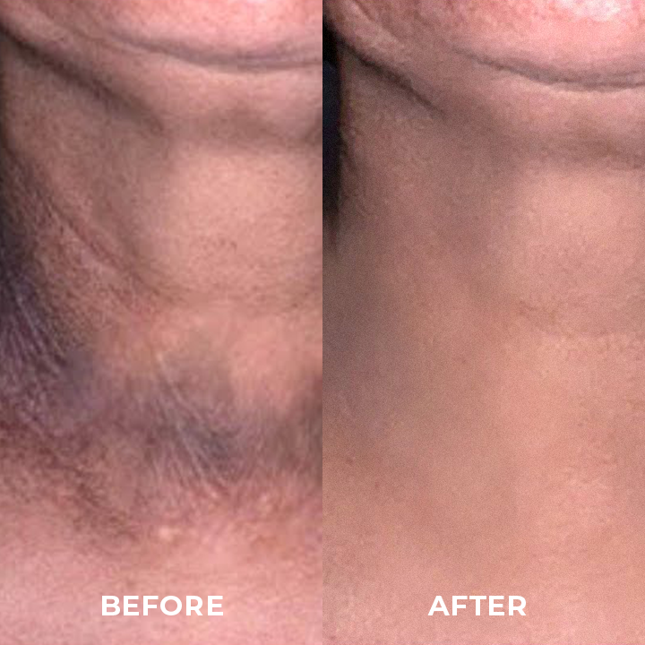 LIMETOW™ Dark Spot Correcting Cream