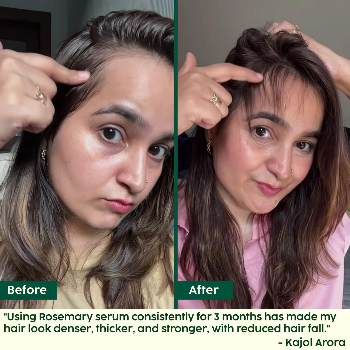 Rosemary Hair Growth Serum (Reduces Hair Fall & Promotes Hair Growth)
