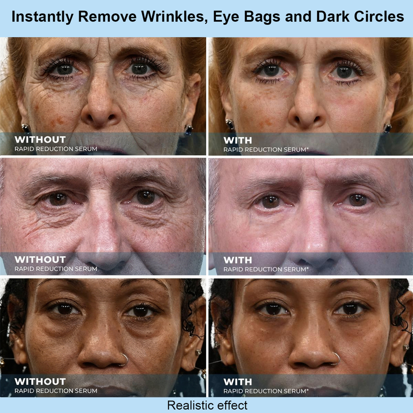 LIMETOW® Instant Face Temporary Tightener – Instant visible results in 60 seconds