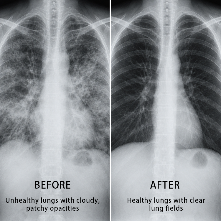 Refresh Your Breathing Routine with Our Pure Botanical Breathing Aid Stick!
