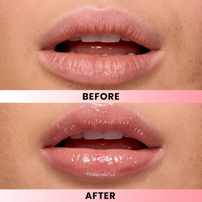 LIMETOW® Lip Softening Serum
