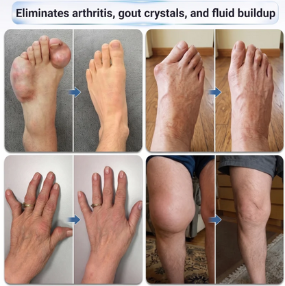 IFMAGIC® FAST‑ACTING JOINT & BONE RELIEF
