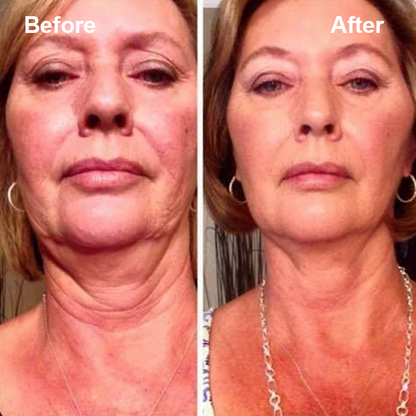 LIMETOW™ Firming & Anti-Wrinkle Neck Cream