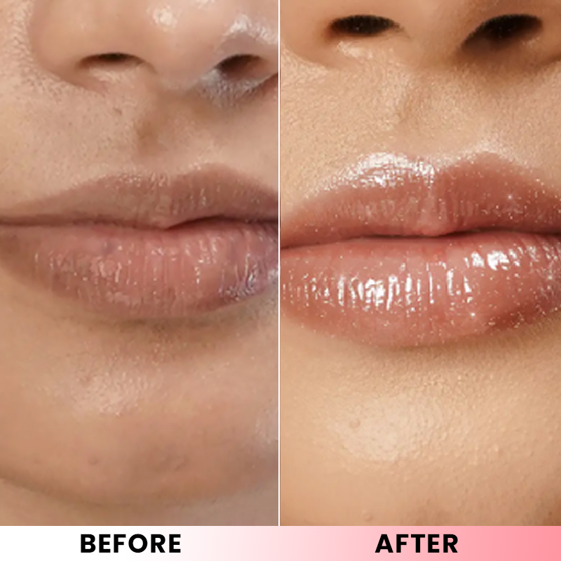 LIMETOW® Lip Softening Serum