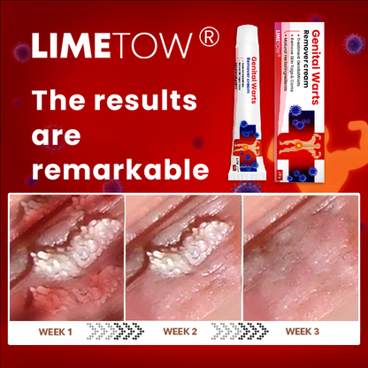 Official Store: LIMETOW® Genital Warts Remover Cream