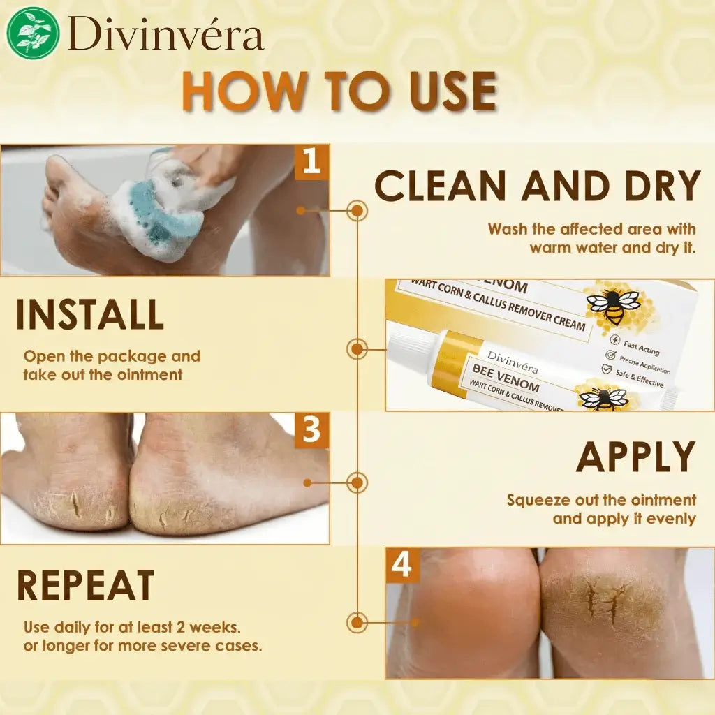 BEE VENOM WART CORN & CALLUS REMOVER CREAM