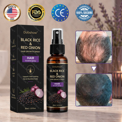 🔥Dobshow® Black Rice & Red Onion Hair Growth Spray