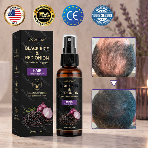 🔥Dobshow® Black Rice & Red Onion Hair Growth Spray