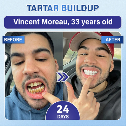 LIMETOW® Tooth & Gum Care Fast-Dissolving Microneedle Patch✨ (𝟓-𝐢𝐧-𝟏 💎 𝐑𝐞𝐛𝐮𝐢𝐥𝐝 𝐄𝐧𝐚𝐦𝐞𝐥 & 𝐃𝐞𝐧𝐭𝐢𝐧 • 𝐒𝐭𝐫𝐞𝐧𝐠𝐭𝐡𝐞𝐧 𝐆𝐮𝐦𝐬 • 𝐄𝐫𝐚𝐝𝐢𝐜𝐚𝐭𝐞 𝐓𝐚𝐫𝐭𝐚𝐫 & 𝐎𝐝𝐨𝐫 • 𝐖𝐡𝐢𝐭𝐞𝐧𝐢𝐧𝐠 • 𝐒𝐭𝐨𝐩 𝐓𝐨𝐨𝐭𝐡 𝐒𝐞𝐧𝐬𝐢𝐭𝐢𝐯𝐢𝐭𝐲)