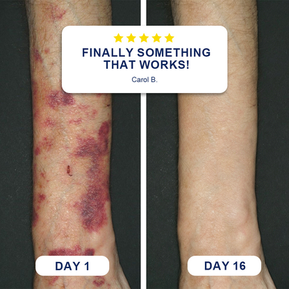 🏆Official US Store🔥LIMETOW® Bruise Repair & Skin-Strengthening Cream