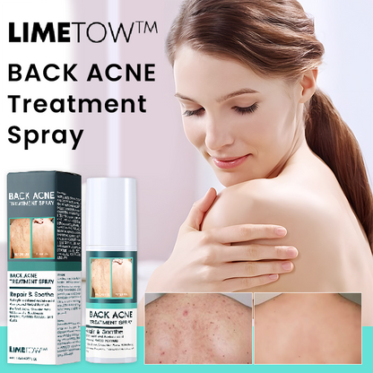 LIMETOW™ Back Acne Treatment Spray