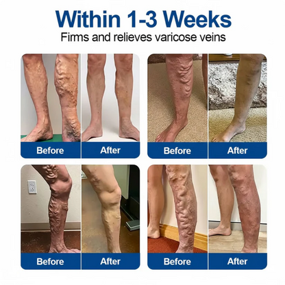 LIMETOW® VeinTarget Microneedle Patch