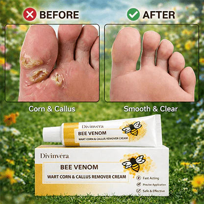 BEE VENOM WART CORN & CALLUS REMOVER CREAM